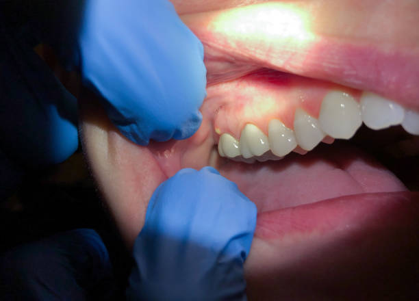 Best Emergency Dentist Near Me  in Buckhall, VA